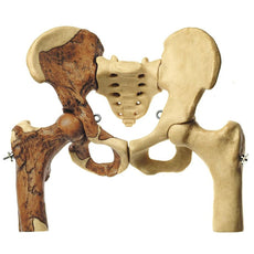 SOMSO Reconstruction of the pelvis of Australopithecus Africanus