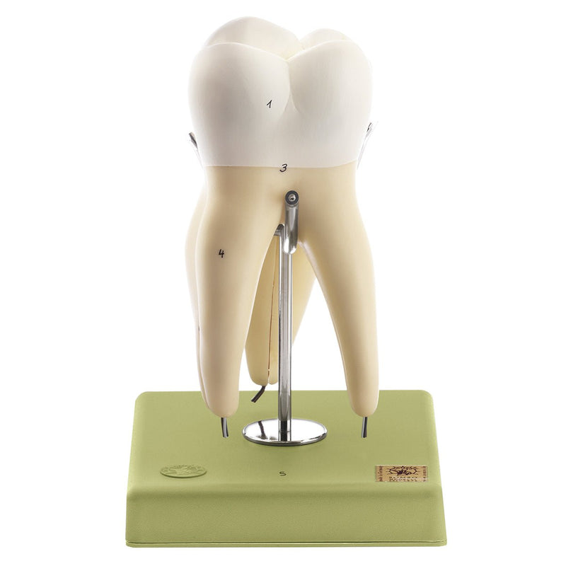 SOMSO Teeth Models, Set of Five