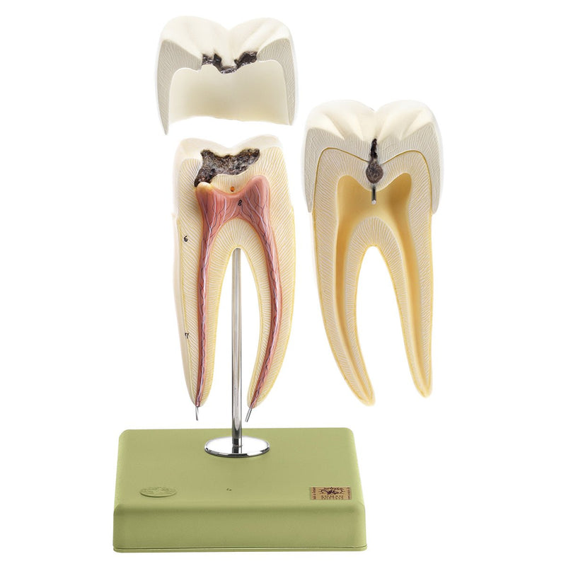 SOMSO Teeth Models, Set of Five