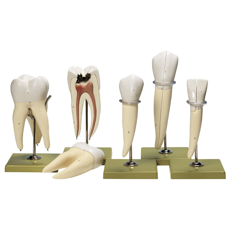 SOMSO Teeth Models, Set of Five