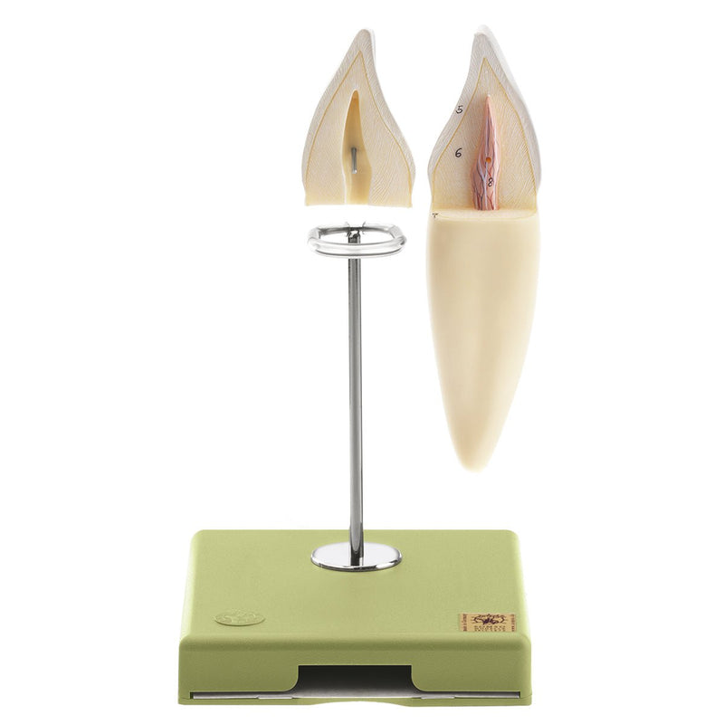 SOMSO Teeth Models, Set of Five