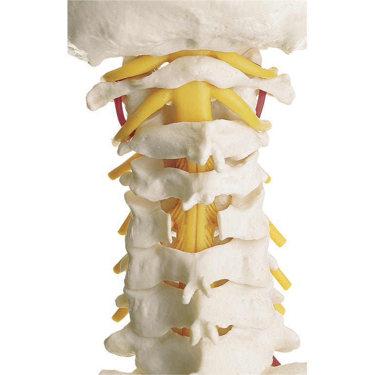 SOMSO Vertebral Column with Pelvis, with prolapsed disc