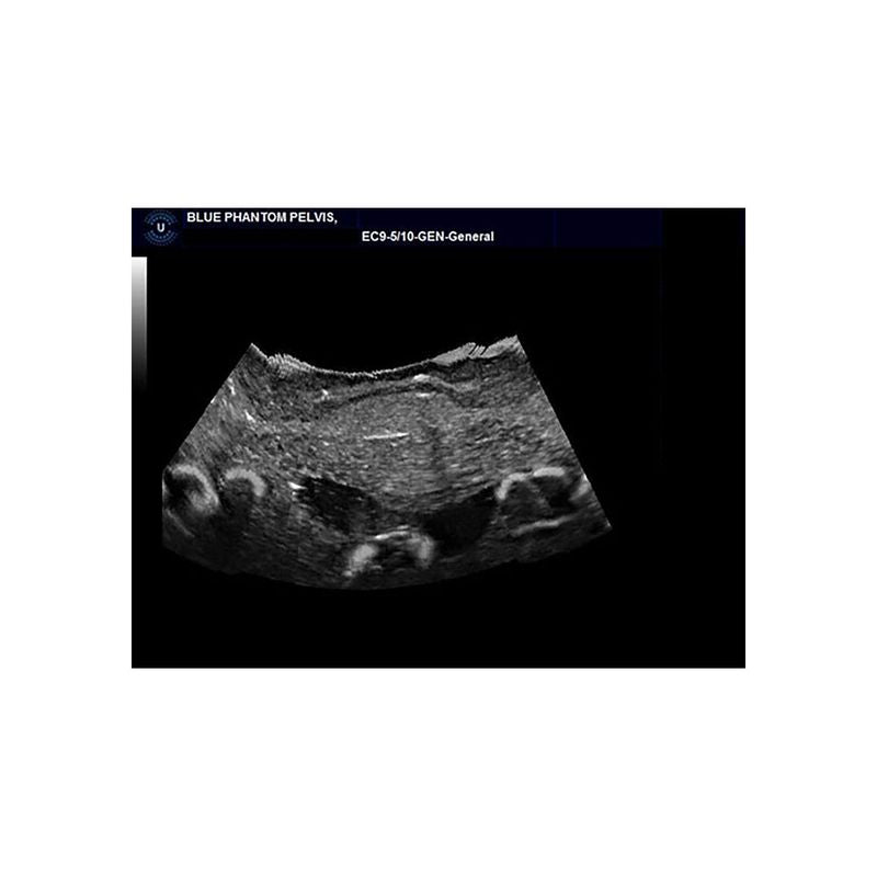 Sonohysterographay & Sonosalpingography Transvaginal Ultrasound Training Model