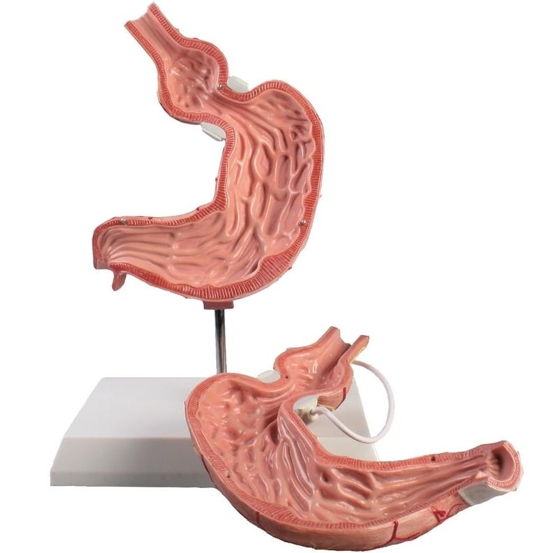 Stomach Model with Gastric Band