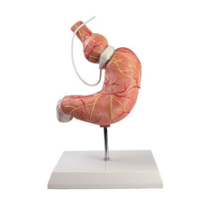 Stomach Model with Gastric Band
