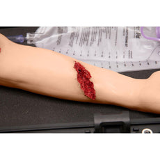 Stop the Bleed Arm with Belt