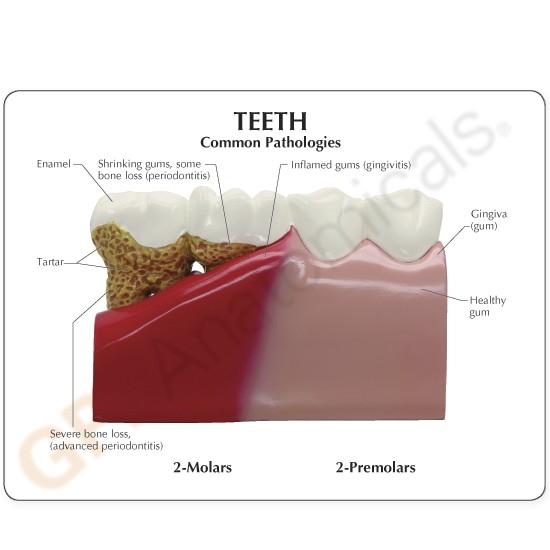 Teeth (oversize) Model