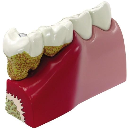Teeth (oversize) Model