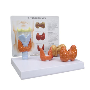 Thyroid Model - set of 4