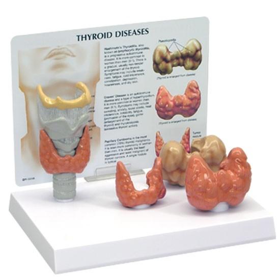 Thyroid Model - set of 4