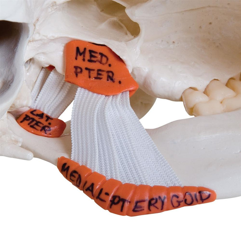 TMJ Skull with masticator muscles, 2 part