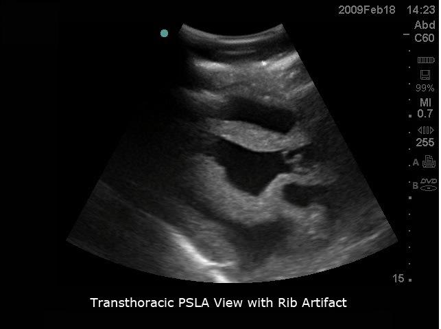 Transesophageal Echo and Transthoracic Echo Training Model