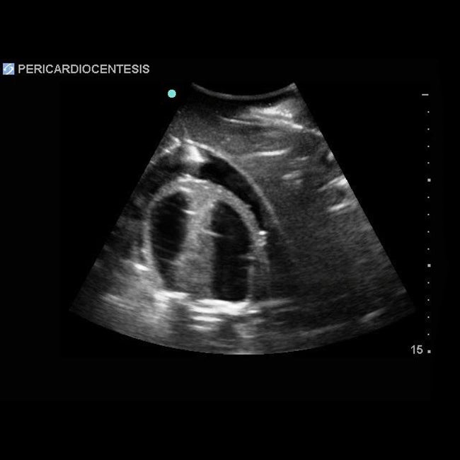Transthoracic Echocardiography and Pericardiocentesis Ultrasound Training Model