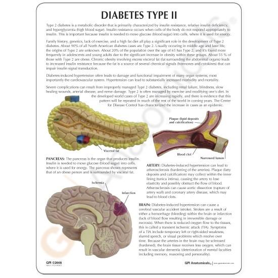 Type II Diabetes Set Model