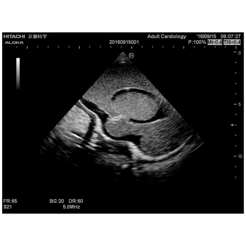 Ultrasound Neonatal Head Phantom, Normal type