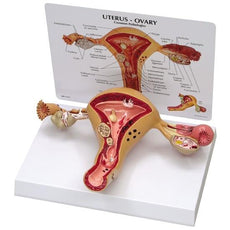 Uterus-Ovary Model with Pathologies