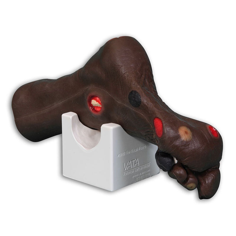 'Wilma' Wound Foot Model, Dark