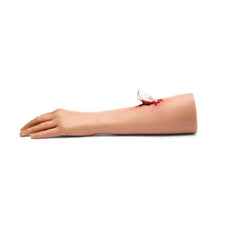 Woman's Arm With Injury