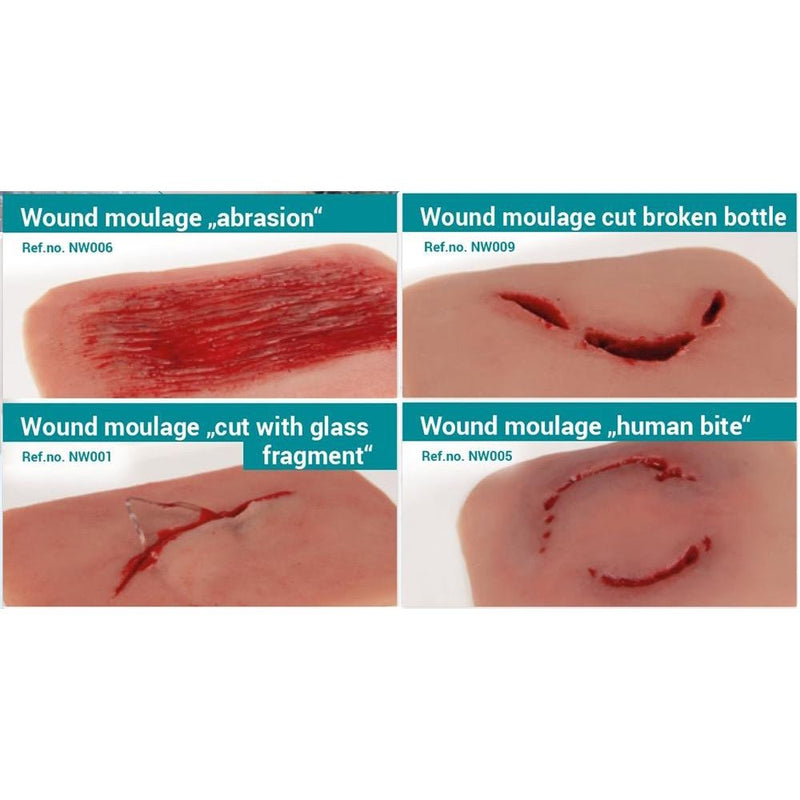 Wound Moulage Abrasion, Cut with Glass and Human Bite Kit