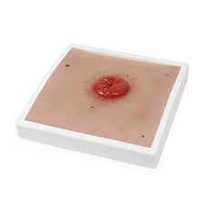 Wound Moulage Colostoma, incl. Stand