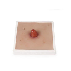 Wound Moulage Ileostoma, incl. Stand