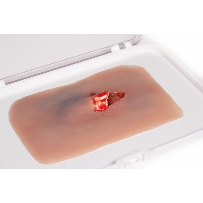 Wound Moulage Open Fracture Kit
