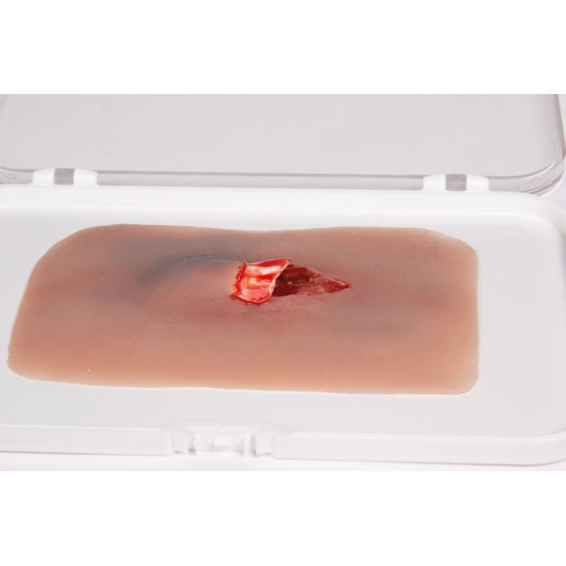 Wound Moulage Open Fracture Kit
