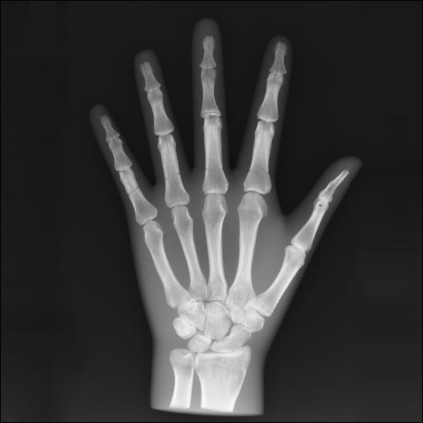 X-Ray Phantom Hand, opaque