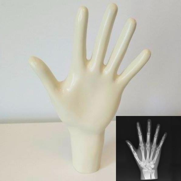 X-Ray Phantom Hand, opaque