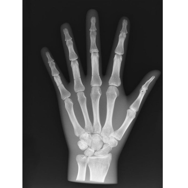 X-Ray Phantom Hand, transparent