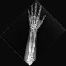 X-Ray Phantom Lower Arm, Transparent