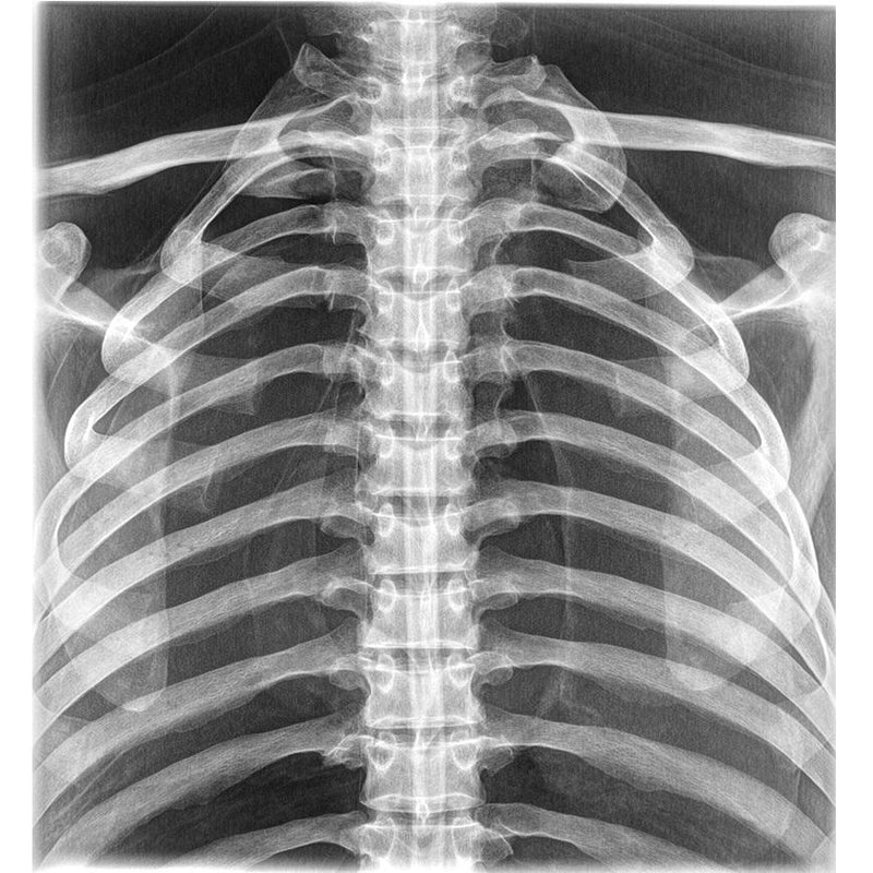 X-Ray Phantom Thorax with Real Human Bones